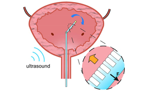 Wireless Acoustic-Surface Actuators for Miniaturized Endoscopes