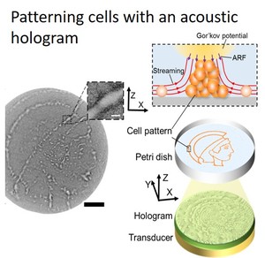 Acoustic Holographic Cell Patterning in a Biocompatible Hydrogel